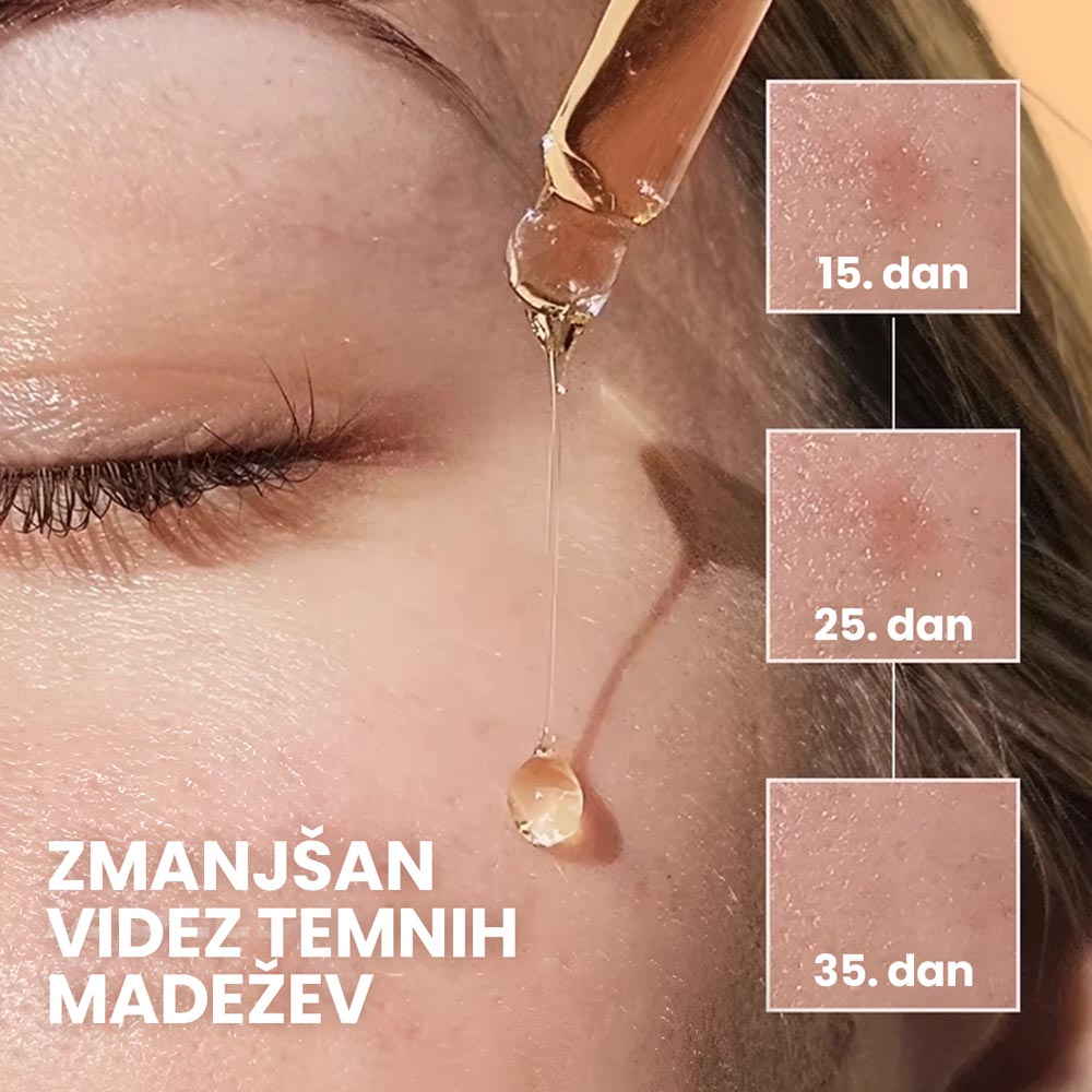 Vitamin C serum for skin