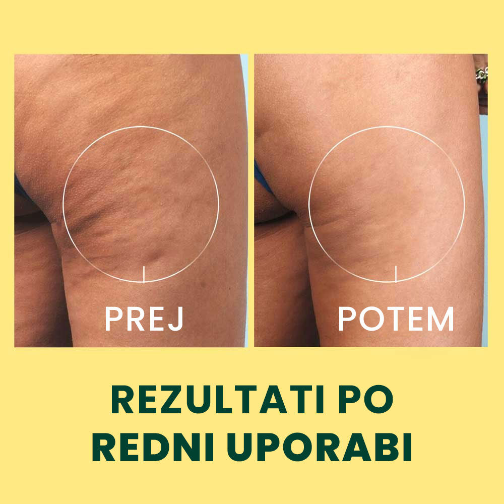 DREN stik proti pomarančni koži