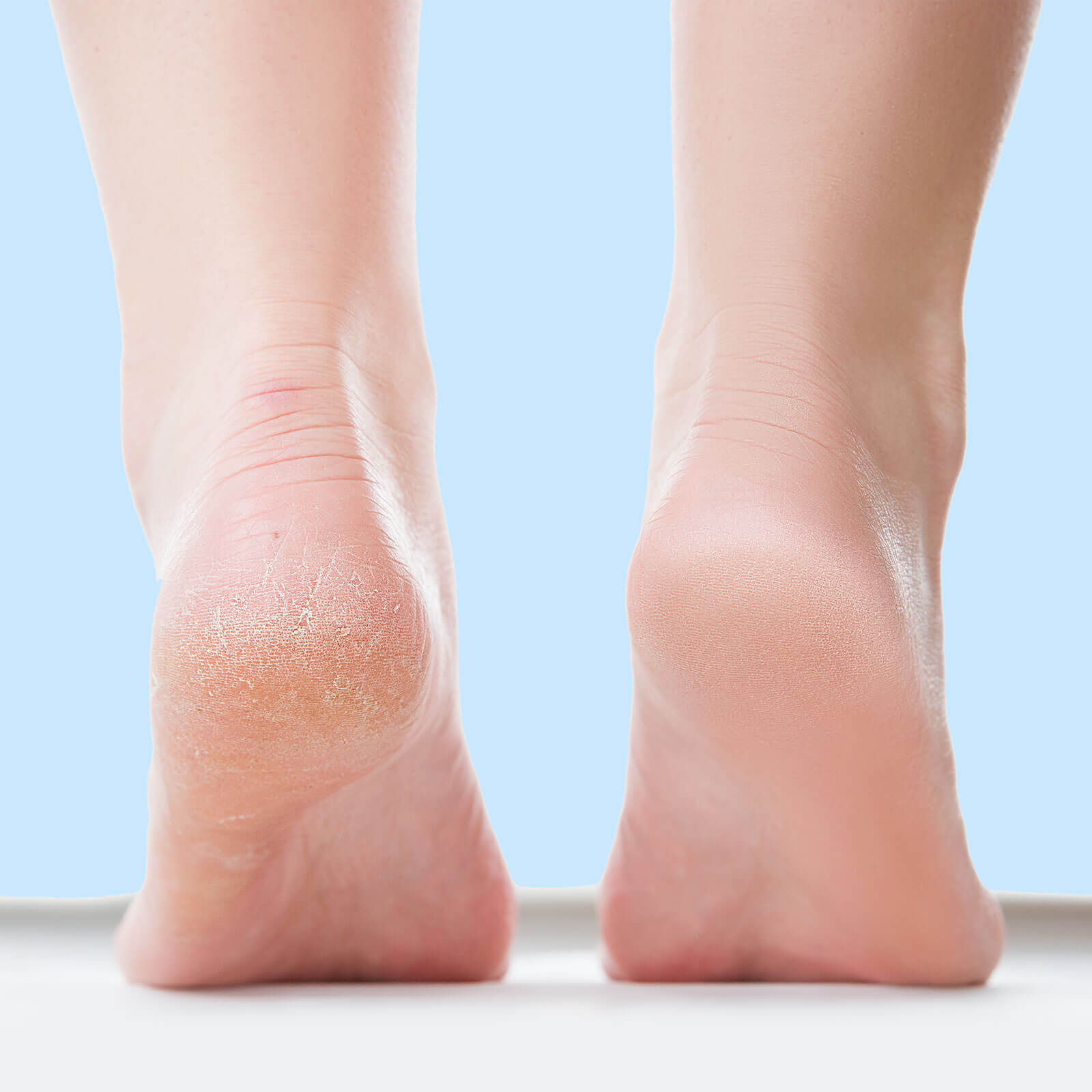 Foot cream